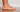 Flat Feet and Overpronation