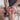 Brace vs Compression Sleeve