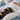 Knee Surgery Recovery: Your First 6 Weeks With a Brace