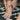 Plantar Fasciitis Treatment: Best Ways to Relieve Heel Pain Fast